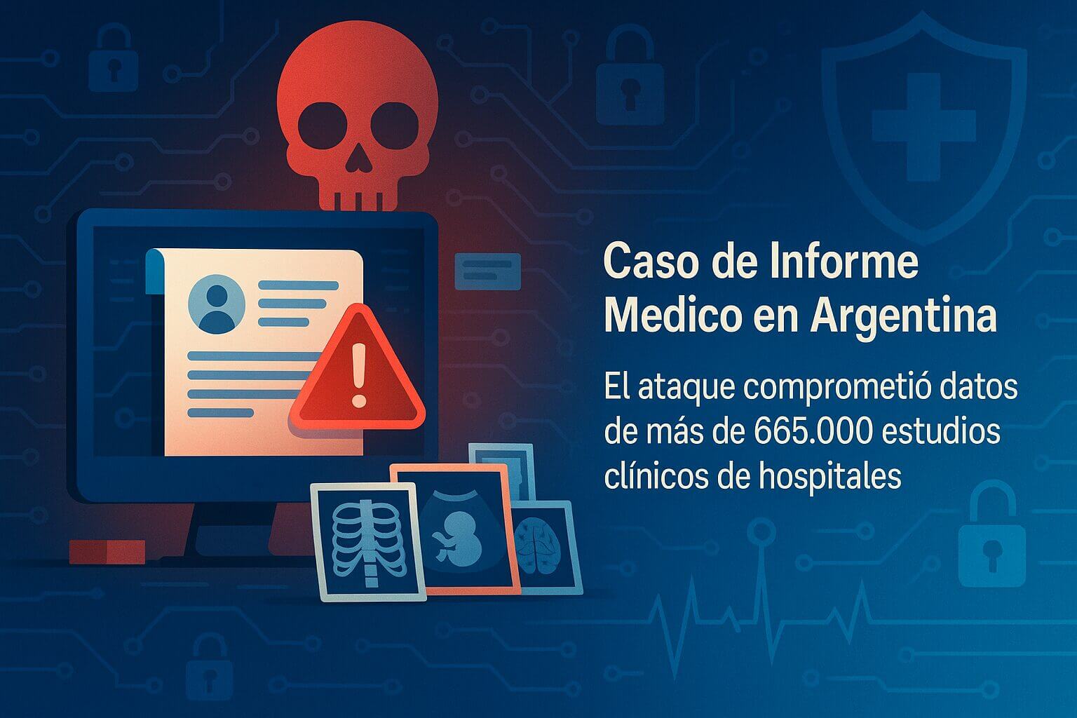 Pantalla con alerta de seguridad, ícono de calavera y estudios clínicos expuestos, que ilustran el caso Informe Médico en Argentina vinculado a ciberseguridad en salud.